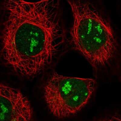 Immunocytochemistry/ Immunofluorescence GPATCH4 Antibody