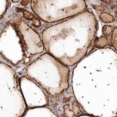 Immunohistochemistry-Paraffin GPATCH4 Antibody