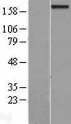 Western Blot: GPATCH8 Overexpression Lysate (Adult Normal) [NBL1-11216] Left-Empty vector transfected control cell lysate (HEK293 cell lysate); Right -Over-expression Lysate for GPATCH8.