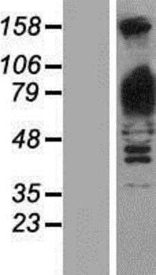 Western Blot Glycogen Phosphorylase BB/GPBB Overexpression Lysate
