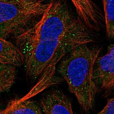 Immunocytochemistry/ Immunofluorescence GPBP Antibody