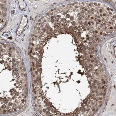 Immunohistochemistry-Paraffin GPBP Antibody