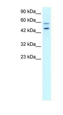 Western Blot: GPBP Antibody [NBP1-80012] - HepG2 cell lysate, Antibody Titration: 0.2-1 ug/ml