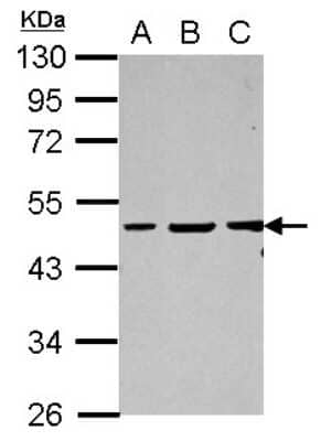 Western Blot: GPBP Antibody [NBP2-16710] - Sample (30 ug of whole cell lysate) A: Jurkat B: K562 C: HL-60 10% SDS PAGE gel, diluted at 1:2000.