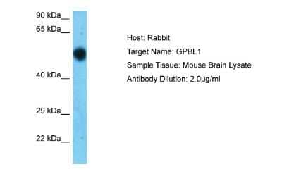Western Blot: GPBP1L1 Antibody [NBP2-82913] - Host: Rabbit. Target Name: GPBL1. Sample Type: Mouse Brain. Antibody Dilution: 1.0ug/ml