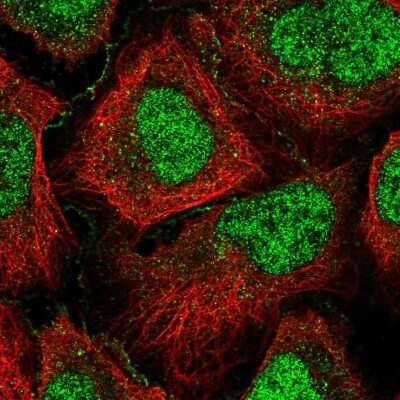 Immunocytochemistry/ Immunofluorescence GPCPD1 Antibody - BSA Free