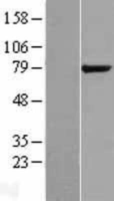 Western Blot GPCPD1 Overexpression Lysate