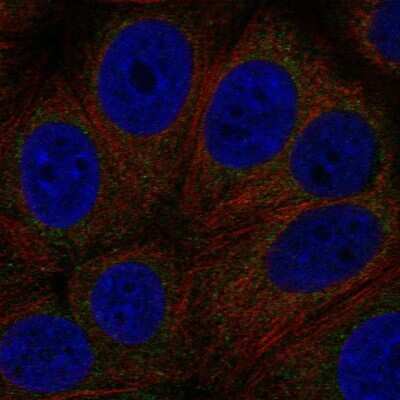 Immunocytochemistry/Immunofluorescence: GPCR GPR89 Antibody [NBP2-55925] - Staining of human cell line MCF7 shows localization to endoplasmic reticulum.