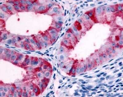 Immunohistochemistry-Paraffin: GPCR GPR89 Antibody [NLS1734] - Analysis of anti-GPR89A antibody with uterus, endometrium.