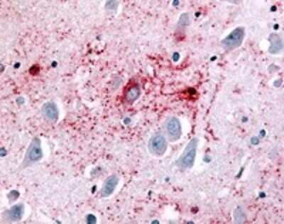 Immunohistochemistry-Paraffin: GPCR GPR89 Antibody [NLS1734] - Analysis of anti-GPR89A antibody with brain, hippocampus at 18 ug/ml.