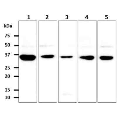 Western Blot: GPD1L Antibody (14E2) [NBP2-59439] - The cell lysates (40ug) were resolved by SDS-PAGE, transferred to PVDF membrane and probed with anti-human GPD1L antibody (1:500). Proteins were visualized using a goat anti-mouse secondary antibody conjugated to HRP and an ECL detection system.Lane 1. : MCF7 cell lysateLane 2. : 293T cell lysateLane 3. : Jurkat cell lysateLane 4 : SW480 cell lysateLane 5 : PC3 cell lysate                            The cell lysates (40ug) were resolved by SDS-PAGE, transferred to PVDF membrane and probed with anti-human GPD1L antibody (1:1000). Proteins were visualized using a goat anti-mouse secondary antibody conjugated to HRP and an ECL detection system.Lane 1. : 293T cell lysateLane 2. : GPD1L Transfected 293T cell lysate