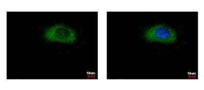 Immunocytochemistry/Immunofluorescence: GPD1L Antibody [NBP1-32279] - Sample: HeLa cells were fixed in 4% paraformaldehyde at RT for 15 min. Green: GPD1 protein stained by GPD1 antibody diluted at 1:500. Blue: Hoechst 33343 staining.