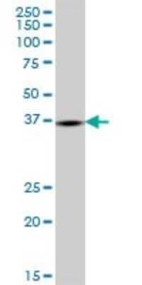 Western Blot: GPD1L Antibody [H00023171-B01P] - Analysis of GPD1L expression in rat brain.