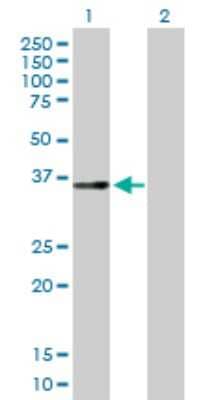 Western Blot: GPD1L Antibody [H00023171-B01P] - Analysis of GPD1L expression in transfected 293T cell line by GPD1L polyclonal antibody.  Lane 1: GPD1L transfected lysate(38.61 KDa). Lane 2: Non-transfected lysate.