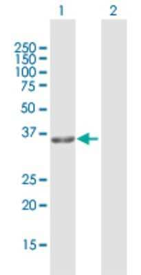 Western Blot: GPD1L Antibody [H00023171-D01P] - Analysis of GPD1L expression in transfected 293T cell line by GPD1L polyclonal antibody.Lane 1: GPD1L transfected lysate(38.40 KDa).Lane 2: Non-transfected lysate.