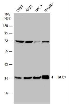 Western Blot: GPD1L Antibody [NBP1-32279] - Various whole cell extracts (30 ug) were separated by 10% SDS-PAGE, and the membrane was blotted with GPD1 antibody  diluted at 1:1000. The HRP-conjugated anti-rabbit IgG antibody (NBP2-19301) was used to detect the primary antibody.