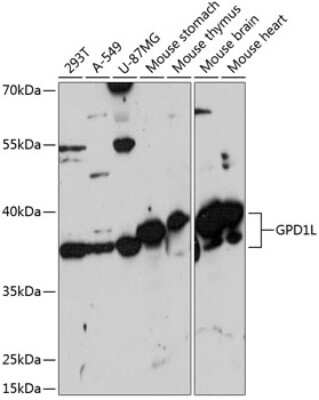 Western Blot: GPD1L Antibody [NBP3-04696] - Analysis of extracts of various cell lines, using GPD1L antibody at 1:3000 dilution. Secondary antibody: HRP Goat Anti-Rabbit IgG (H+L) at 1:10000 dilution. Lysates/proteins: 25ug per lane. Blocking buffer: 3% nonfat dry milk in TBST. Detection: ECL Basic Kit