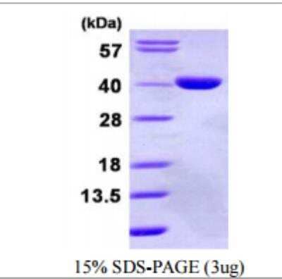 SDS-Page: GPD1L Recombinant Protein [NBP1-72456]