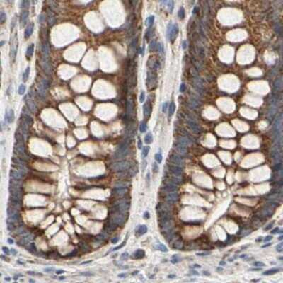 Immunohistochemistry-Paraffin: GPD2 Antibody [NBP1-86121] - Staining of human colon.