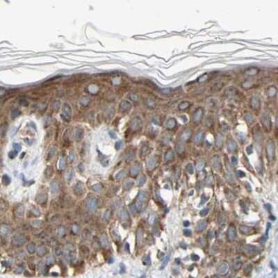 Immunohistochemistry-Paraffin: GPD2 Antibody [NBP1-86121] - Staining of human skin.