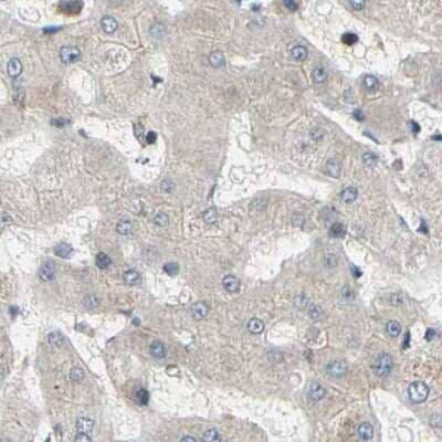 Immunohistochemistry-Paraffin: GPD2 Antibody [NBP1-86121] - Staining of human liver using Anti-GPD2 antibody NBP1-86121.