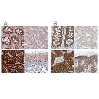 <b>Independent Antibodies Validation and Orthogonal Strategies Validation.</b>Immunohistochemistry-Paraffin: GPD2 Antibody [NBP2-38542] - Staining of human colon, liver, parathyroid gland and skin using Anti-GPD2 antibody NBP2-38542 (A) shows similar protein distribution across tissues to independent antibody NBP1-86121 (B).