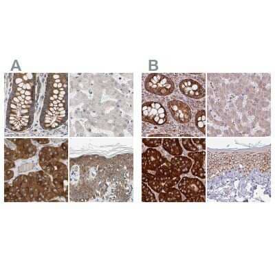 Western Blot: GPD2 Antibody [NBP1-86121] - Staining of human colon, liver, parathyroid gland and skin using Anti-GPD2 antibody NBP1-86121 (A) shows similar protein distribution across tissues to independent antibody NBP2-38542 (B).