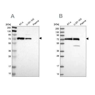 Western Blot: GPD2 Antibody [NBP1-86121] - Analysis using Anti-GPD2 antibody NBP1-86121 (A) shows similar pattern to independent antibody NBP2-38542 (B).