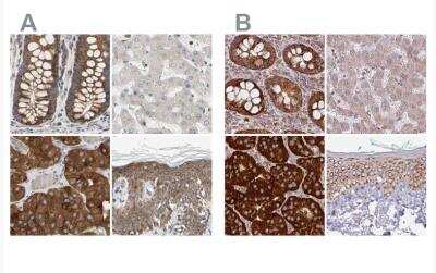 Western Blot: GPD2 Antibody [NBP1-86121] - Staining of human colon, liver, parathyroid gland and skin using Anti-GPD2 antibody NBP1-86121 (A) shows similar protein distribution across tissues to independent antibody NBP2-38542 (B).