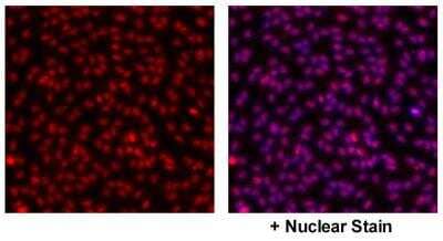 Immunocytochemistry/Immunofluorescence: GPER/GPR30 Antibody [NBP1-31239] - Detection of GPER/GPR30 in HUVEC nucleus. Image courtesy of a product review by Dr. Subhadeep Chakrabarti of University of Alberta.