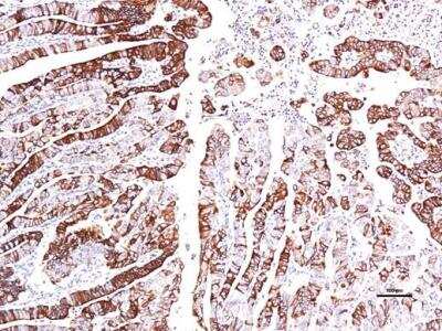 Immunohistochemistry-Paraffin: GPER/GPR30 Antibody [NBP1-31258] - Paraffin-embedded endometrial, using antibody at 1:150 dilution.