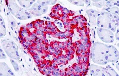 Immunohistochemistry-Paraffin: GPER/GPR30 Antibody [NLS1183] - Analysis of anti-GPER1 / GPR30 antibody with human, pancreas, islet.