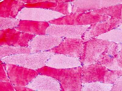 Immunohistochemistry-Paraffin: GPER/GPR30 Antibody [NLS4268] - Analysis of anti-GPR30 antibody with human skeletal muscle at dilution 5 - 7.5 ug/ml.