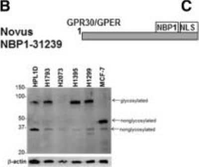 Western Blot: GPER/GPR30 Antibody [NBP1-31239] - The MW of GPR30 is estimated to be 42 kDa, but higher MW sizes have been reported due to glycosylation and interaction with other proteins. Bands are identified as glycosylated and nonglycosylated based on reports cited in the text, but could include interaction with other proteins. For each GPER western, the membrane was stripped and reprobed for b-actin as a loading control. Quantitation of GPER was evaluated by summing all immunoreactive bands and dividing by b-actin, then normalizing to HBEC2-KT in each blot. Image collected and cropped by CiteAb from the following publication (biomedcentral.com/1471-2407/12/624), licensed under a CC-BY license.