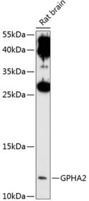 Western Blot: GPHA2 Antibody [NBP3-04883] - Analysis of extracts of rat brain, using GPHA2 antibody at 1:1000 dilution. Secondary antibody: HRP Goat Anti-Rabbit IgG (H+L) at 1:10000 dilution. Lysates/proteins: 25ug per lane. Blocking buffer: 3% nonfat dry milk in TBST. Detection: ECL Enhanced Kit .