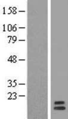 Western Blot: GPHA2 Overexpression Lysate (Adult Normal) [NBL1-11228] Left-Empty vector transfected control cell lysate (HEK293 cell lysate); Right -Over-expression Lysate for GPHA2.