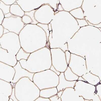 Immunohistochemistry-Paraffin: GPIHBP1 Antibody [NBP2-47445] - Staining of human breast shows moderate cytoplasmic positivity in adipocytes.