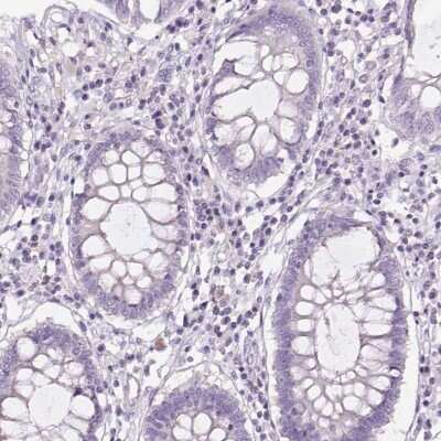 Immunohistochemistry-Paraffin: GPIHBP1 Antibody [NBP2-47445] - Staining of human colon shows low expression as expected.