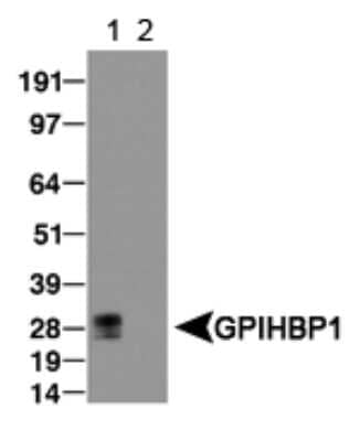 Western Blot: GPIHBP1 Antibody [NB110-41537] - (1) Detection of GPIHBP1in transfected lysate and (2) empty vector lysate was used as a negative control.