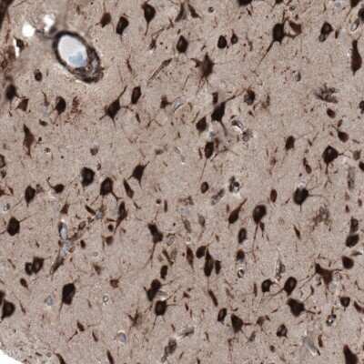 Immunohistochemistry-Paraffin GPIP137 Antibody