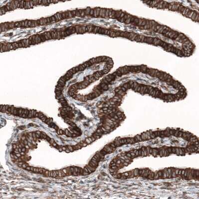 Immunohistochemistry-Paraffin GPIP137 Antibody