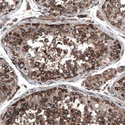 Immunohistochemistry-Paraffin: GPIP137 Antibody [NBP1-88195] - Staining of human testis shows moderate to strong cytoplasmic positivity in cells in seminiferous ducts.