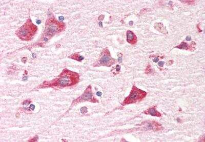 Immunohistochemistry-Paraffin: GPIP137 Antibody [NBP2-42504] - Staining of paraffin embedded Human Cortex. Antibody at 5 ug/mL. Steamed antigen retrieval with citrate buffer pH 6, AP-staining.