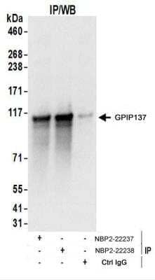 <b>Biological Strategies Validation. </b>Immunoprecipitation: GPIP137 Antibody [NBP2-22237] - Whole cell lysate (1 mg for IP; 20% of IP loaded) from HeLa cells.  Antibodies:  Affinity purified rabbit anti-GPIP137 antibody NBP2-22237 used for IP at 6 ug/mg lysate.  GPIP137 was also immunoprecipitated by rabbit anti-GPIP137 antibody NBP2-22238.  For blotting immunoprecipitated GPIP137, NBP2-22237 was used at 1 ug/ml.  Detection: Chemiluminescence with an exposure time of 1 second.