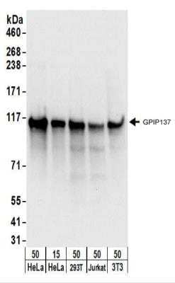 Western Blot: GPIP137 Antibody [NBP2-22237] - Whole cell lysate from HeLa (15 and 50 ug), 293T (50 ug), Jurkat (50 ug),  and mouse NIH3T3 (50 ug) cells.   NBP2-22237 used for WB at 0.1 ug/ml.    Detection: Chemiluminescence with an exposure time of 3 seconds.