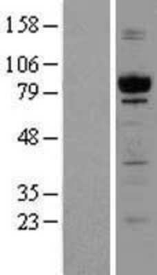 Western Blot: GPIP137 Overexpression Lysate (Adult Normal) [NBL1-08687] Left-Empty vector transfected control cell lysate (HEK293 cell lysate); Right -Over-expression Lysate for GPIP137.