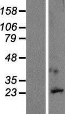 Western Blot: GPM6A Overexpression Lysate (Adult Normal) [NBP2-04602] Left-Empty vector transfected control cell lysate (HEK293 cell lysate); Right -Over-expression Lysate for GPM6A.