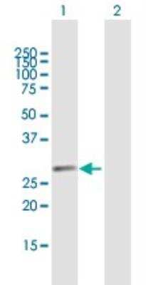 Western Blot: GPN2 Antibody [H00054707-B03P] - Analysis of GPN2 expression in transfected 293T cell line. Lane 1: ATPBD1B transfected lysate (34.1 KDa). Lane 2: Non-transfected lysate.