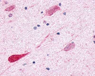 Immunohistochemistry-Paraffin: GPR1 Antibody [NLS77] - Analysis of anti-GPR1 antibody with human brain, neurons and glia at 9 ug/ml.