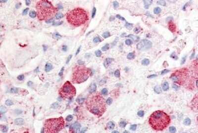 Immunohistochemistry-Paraffin: GPR10 Antibody [NBP1-02337] - Staining of human anterior pituitary. Immunohistochemistry of formalin-fixed, paraffin-embedded tissue after heat-induced antigen retrieval. Antibody concentration 10 ug/ml.